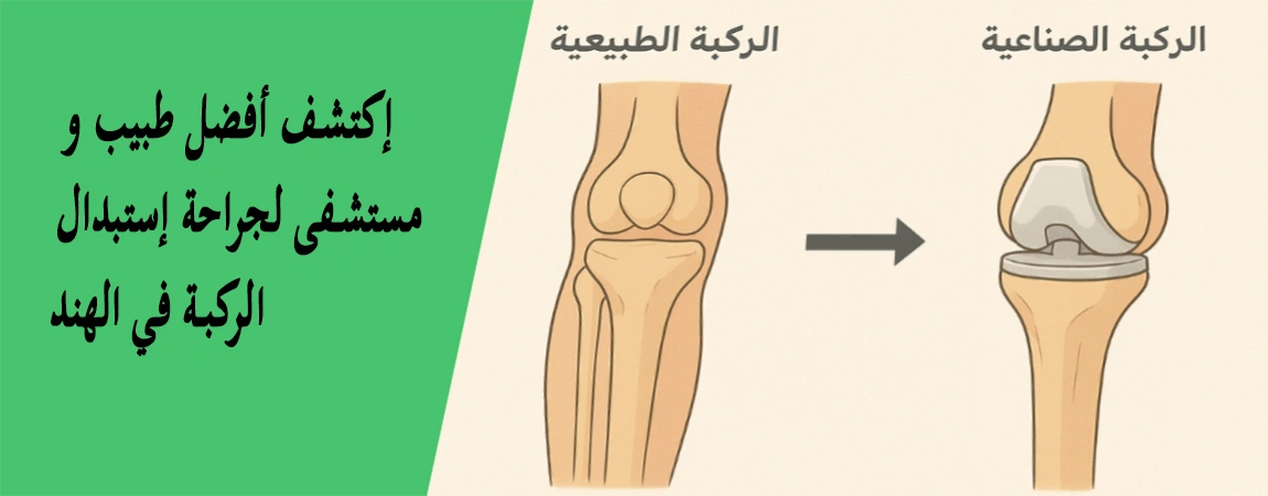 جراحة إستبدال الركبة في الهند - التكلفة، الأطباء، المستشفيات