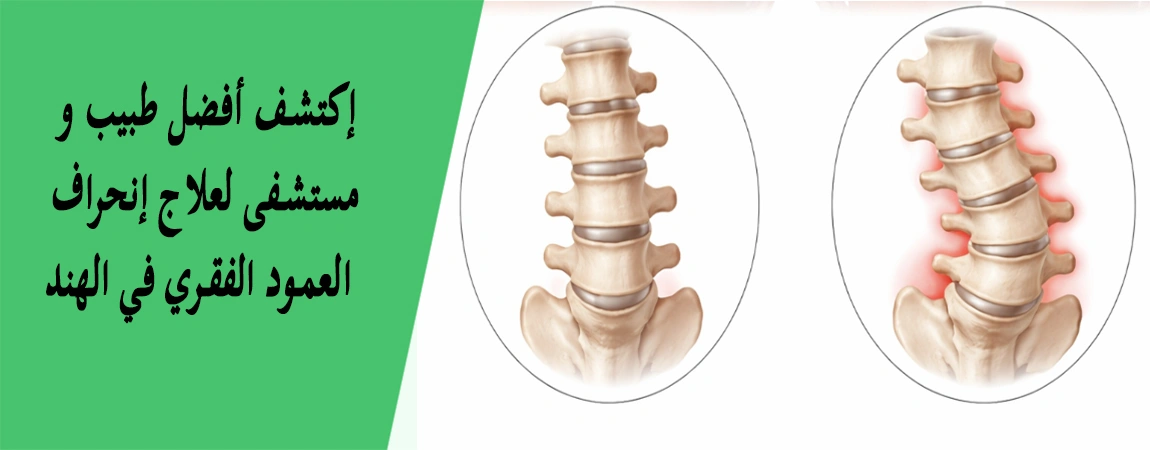 جراحة الجنف والعمود الفقري في الهند