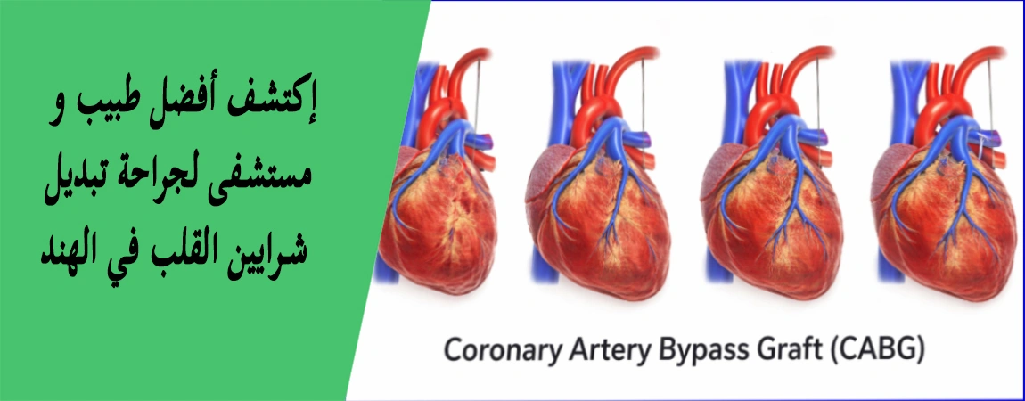 جراحة إستبدال شرايين القلب في الهند | أفضل المستشفيات والتكاليف