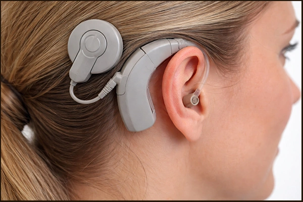 تكلفة زراعة القوقعة في الهند – أفضل طبيب ومستشفى