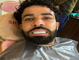 Dental Implant Surgery in India Types, Benefits & Cost