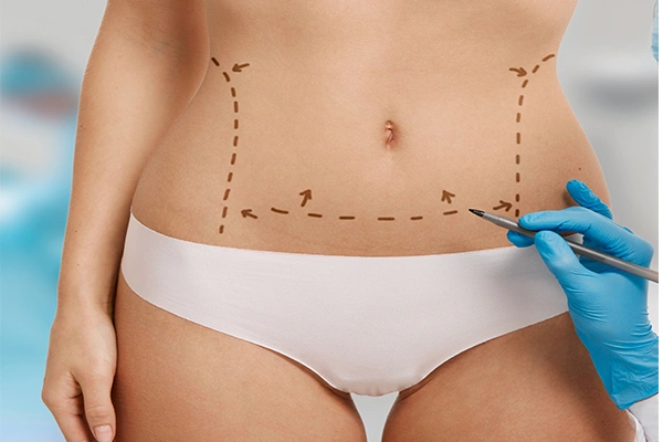 Liposuction Surgery Cost in India | Compare Prices